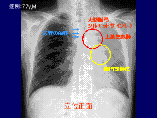 胸部のCT CT装置のご紹介 ｜ こうのす共生病院｜埼玉県鴻巣市